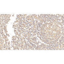 Complement Receptor Type 1 / CD35 (CR1) Antibody