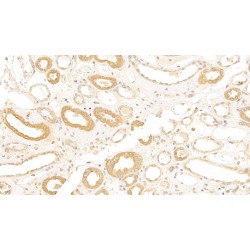 Complement Receptor Type 1 / CD35 (CR1) Antibody