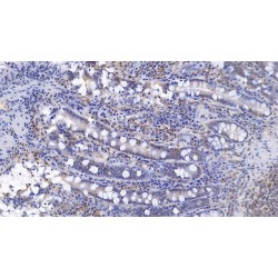 Complement Receptor Type 1 / CD35 (CR1) Antibody