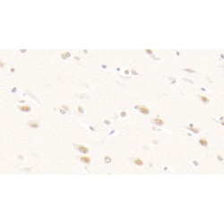 Fibroblast Growth Factor 2 (FGF2) Antibody