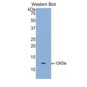 Western blot analysis of the recombinant protein.