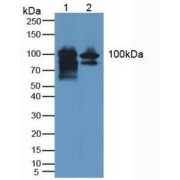 abx103424