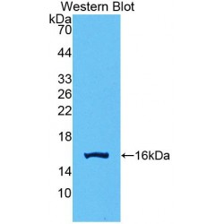 Growth Differentiation Factor 15 (GDF15) Antibody