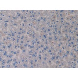 Growth Differentiation Factor 15 (GDF15) Antibody