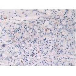 Hypoxia Inducible Factor 1 Alpha (HIF1a) Antibody