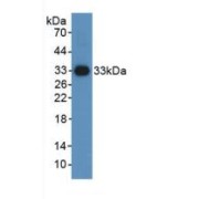 Western blot analysis of recombinant Mouse HIF1a.