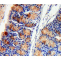 Hypoxia Inducible Factor 1 Alpha (HIF1a) Antibody