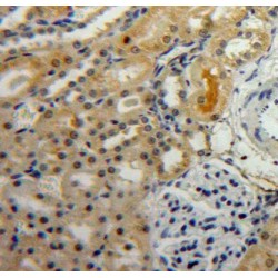 Hypoxia Inducible Factor 1 Alpha (HIF1a) Antibody