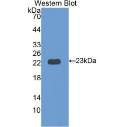 Interleukin 12 Receptor Beta 1 (IL12Rb1) Antibody