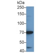 Western blot analysis of BXPC3 cell lysates, using Rabbit Anti-Human IL12Rb2 Antibody (1 µg/ml) and HRP-conjugated Goat Anti-Rabbit antibody (<a href="https://www.abbexa.com/index.php?route=product/search&amp;search=abx400043" target="_blank">abx400043</a>, 0.2 µg/ml).