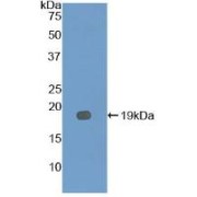 Western blot analysis of recombinant Mouse IL12Rb2.