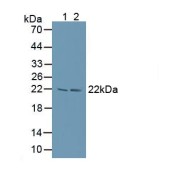 Western blot analysis of (1) Human Lung Tissue and (2) Bovine Lymphocytes Cells.