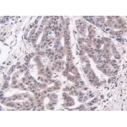 Large Multifunctional Peptidase 7 (LMP7) Antibody