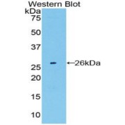 Western blot analysis of the recombinant protein.