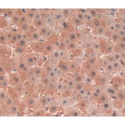 Lipopolysaccharide Binding Protein (LBP) Antibody