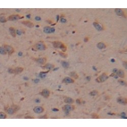Lipopolysaccharide Binding Protein (LBP) Antibody