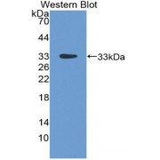 Western blot analysis of recombinant Rat LBP.