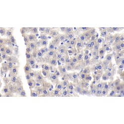 Lipopolysaccharide Binding Protein (LBP) Antibody