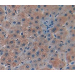 Macrophage Inflammatory Protein 5 (MIP5) Antibody