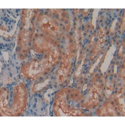 N-Acetyl Alpha-D-Glucosaminidase (NAGLU) Antibody