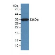Western blot analysis of recombinant Human NAGase.