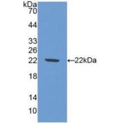 Nitric Oxide Synthase 1 (NOS1) Antibody
