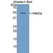 Western blot analysis of the recombinant protein.