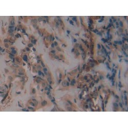 Plasminogen Activator Inhibitor 1 (PAI1) Antibody