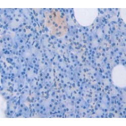 Platelet Derived Growth Factor C (PDGFC) Antibody