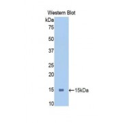 Western blot analysis of recombinant Mouse PIGR Protein.