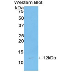 Polymeric Immunoglobulin Receptor (PIGR) Antibody