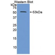 Western blot analysis of recombinant Human PSMC2 Protein.