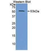 Western blot analysis of recombinant Human PSMC2 Protein.