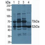 Western blot analysis of (1) Human 293T cells, (2) Human HeLa cells, (3) Human HepG2 cells and (4) Human Saliva Tissue.