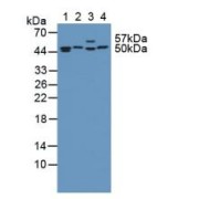 IHC-P analysis of Human Kidney Tissue, with DAB staining.