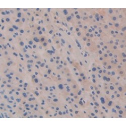 Puromycin Sensitive Aminopeptidase (PSA) Antibody