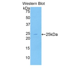 Puromycin Sensitive Aminopeptidase (PSA) Antibody