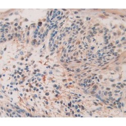 Quiescin Q6 Sulfhydryl Oxidase 1 (QSOX1) Antibody