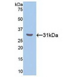 RAR Related Orphan Receptor Alpha (RORa) Antibody