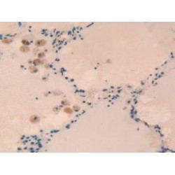 RAR Related Orphan Receptor Gamma (RORg) Antibody