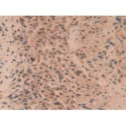 RAR Related Orphan Receptor Gamma (RORg) Antibody