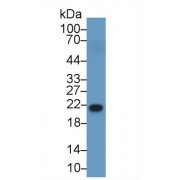 Western blot analysis of Human Serum, using Human RBP4 Antibody (1 µg/ml) and HRP-conjugated Goat Anti-Rabbit antibody (<a href="https://www.abbexa.com/index.php?route=product/search&amp;search=abx400043" target="_blank">abx400043</a>, 0.2 µg/ml).