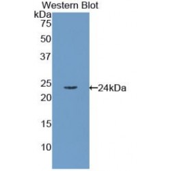 Retinol Binding Protein 4, Plasma (RBP4) Antibody