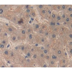 Retinol-Binding Protein 4 (RBP4) Antibody