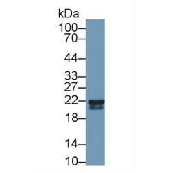 Retinol-Binding Protein 4 (RBP4) Antibody