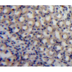 S100 Calcium Binding Protein A3 (S100A3) Antibody
