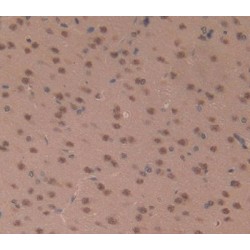 S100 Calcium Binding Protein A5 (S100A5) Antibody