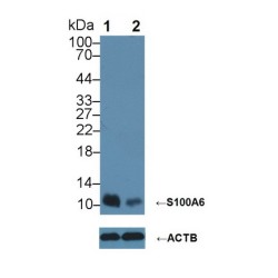 S100 Calcium Binding Protein A6 (S100A6) Antibody