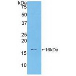 S100 Calcium Binding Protein A6 (S100A6) Antibody