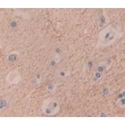 S100 Calcium Binding Protein A6 (S100A6) Antibody